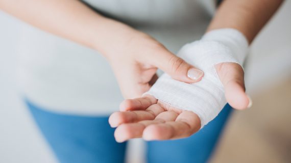 Personal injury